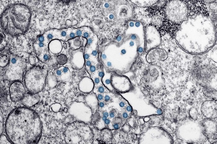 Interactive: COVID-19 Cases by Health District in Utah